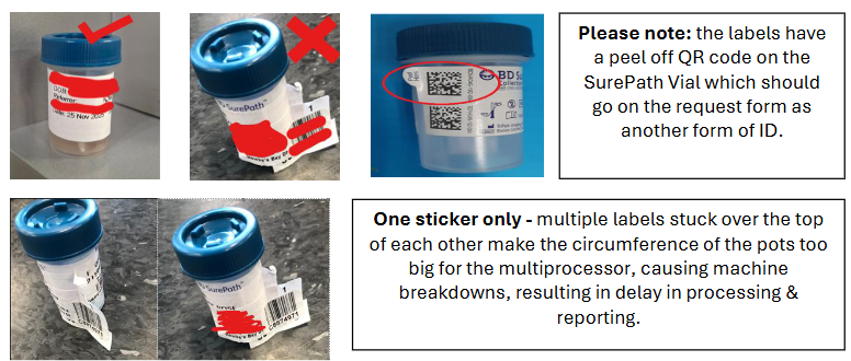 SurePath LBC Sample Labelling
