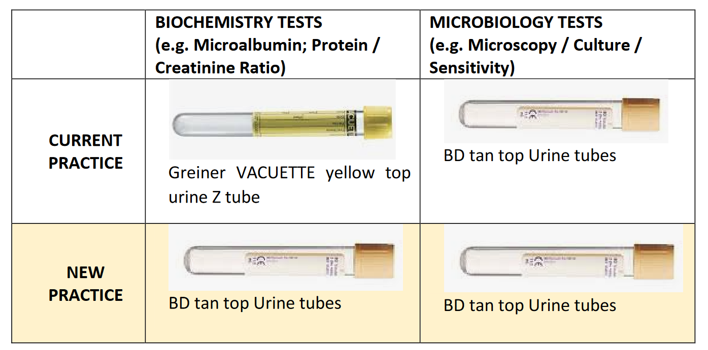 Table showing current urine tubes and new tubes